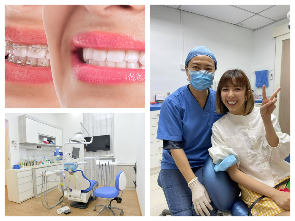 Smile Confidently with Braces: Top Dental Clinics in KL and Selangor